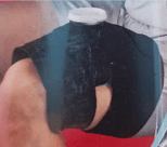 Ice Bag Wrap